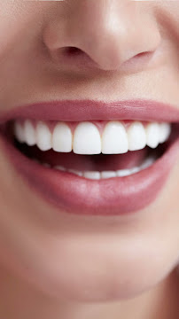 Good dental clinic Kathu Phuket คลินิกทันตกรรมกู๊ด กะทู้ จัดฟัน ฟอกฟันขาว รักษารากฟัน รากฟันเทียม ครอบฟัน วีเนียร์ ภูเก็ต