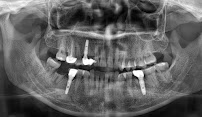 Angkor kampuchea dental clinic