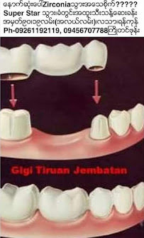 24hour dental clinic Super Star သွားဆေးခန်းများ