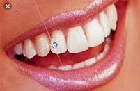 24hour dental clinic Super Star သွားဆေးခန်းများ