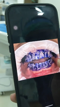 D’ Lux Complete Dentistry Yankin Branch