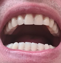 Dental - Centar Štimac