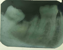 Dentaly Clinica Dental Merida