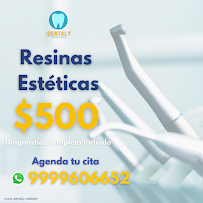 Dentaly Clinica Dental Merida