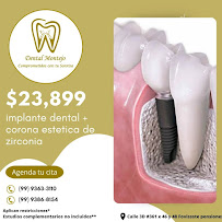 Dental Montejo