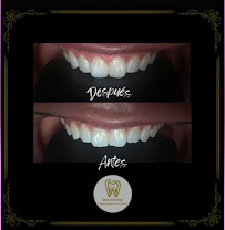 Dental Montejo