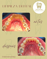 Dental Montejo