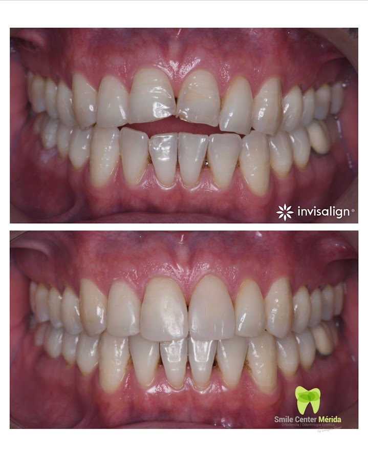 Smile Center Mérida By Georgina Flores Avalos - dental clinic in Merida, Mexico
