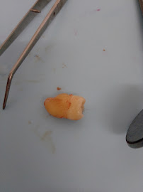 Dentist Merida 🦷 [ DENTUM Clínica Dental ]