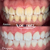Clínica Dental Dentiréz | Dentista en Mérida