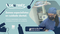 Clínica Dental Dentiréz | Dentista en Mérida