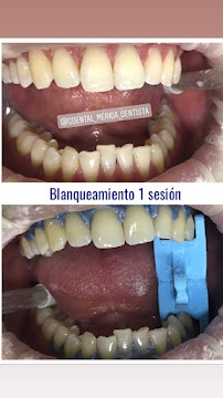 G dental Consultorio Mérida