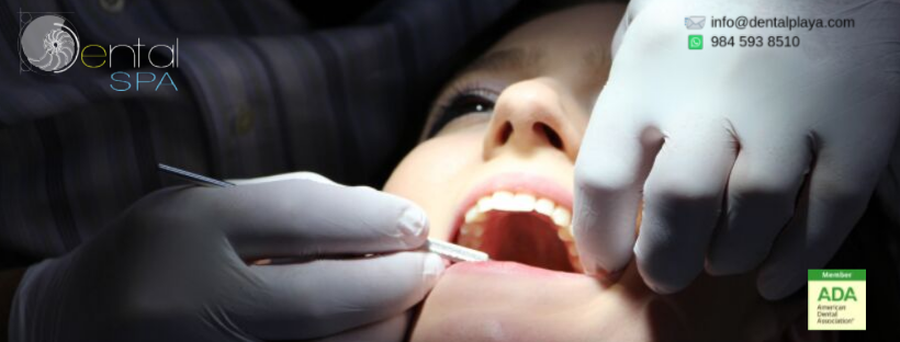 DentalSPA, Dentistas en Playa del Carmen - dental clinic in Playa Del Carmen, Mexico