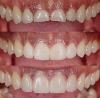 DentalSPA, Dentistas en Playa del Carmen