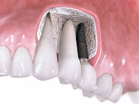 DentalSPA, Dentistas en Playa del Carmen