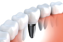 DentalSPA, Dentistas en Playa del Carmen