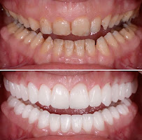 DentalSPA, Dentistas en Playa del Carmen