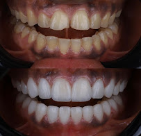 DentalSPA, Dentistas en Playa del Carmen