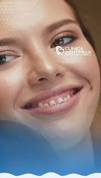 DentPrax Clínica Odontológica En Playa del Carmen | Dentista