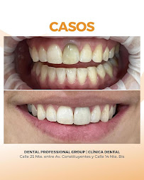 Dental Professional Group | Dentista | Playa Del Carmen | Clínica dental