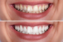 Dental Professional Group | Dentista | Playa Del Carmen | Clínica dental