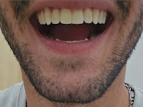 Dental Professional Group | Dentista | Playa Del Carmen | Clínica dental