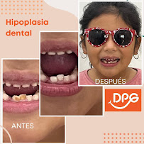 Dental Professional Group | Dentista | Playa Del Carmen | Clínica dental