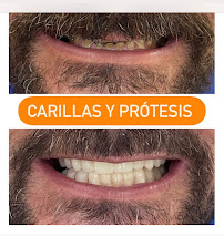 Dental Professional Group | Dentista | Playa Del Carmen | Clínica dental