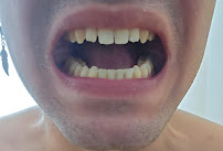 Dental Professional Group | Dentista | Playa Del Carmen | Clínica dental