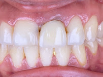DENTAL HOUSE ADA U.S. INSURANCE DIRECT