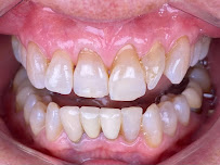 DENTAL HOUSE ADA U.S. INSURANCE DIRECT