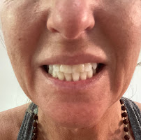 DENTAL HOUSE ADA U.S. INSURANCE DIRECT