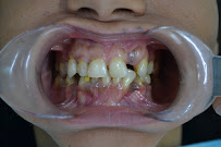 DENTAL HOUSE ADA U.S. INSURANCE DIRECT