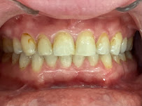 DENTAL HOUSE ADA U.S. INSURANCE DIRECT