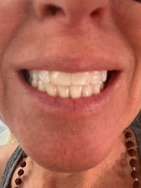 DENTAL HOUSE ADA U.S. INSURANCE DIRECT