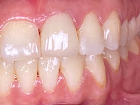 DENTAL HOUSE ADA U.S. INSURANCE DIRECT