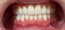 DENTAL HOUSE ADA U.S. INSURANCE DIRECT