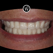 WHITE COAST Restorative Dentistry