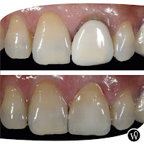 WHITE COAST Restorative Dentistry