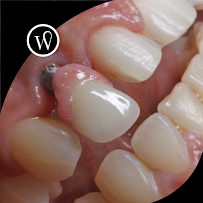 WHITE COAST Restorative Dentistry