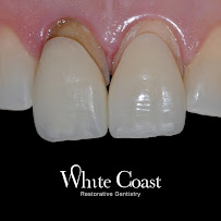WHITE COAST Restorative Dentistry