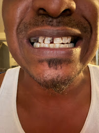 Smile MakeOver Playa