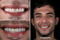 Smile MakeOver Playa