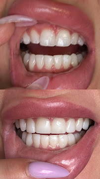Smile MakeOver Playa