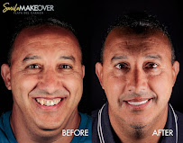 Smile MakeOver Playa