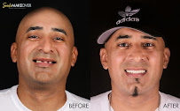 Smile MakeOver Playa
