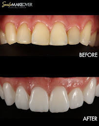 Smile MakeOver Playa