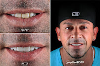 Smile MakeOver Playa