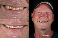 Smile MakeOver Playa