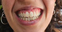 INFINITE SMILE 8 Odontologia Personalizada
